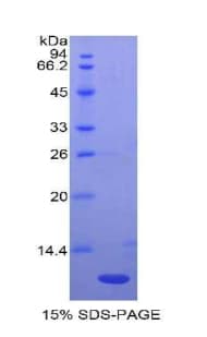 Rat CCL4 / MIP-1 Beta Protein (Recombinant His)