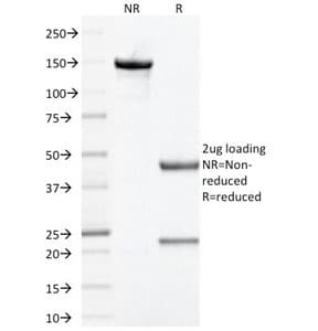 PHB / Prohibitin Antibody (clone PHB/1881, Ready-to-Use)