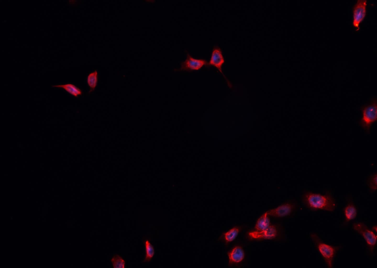 FOXA1 Antibody
