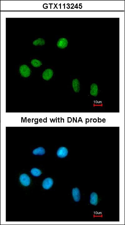 PIN1 Antibody