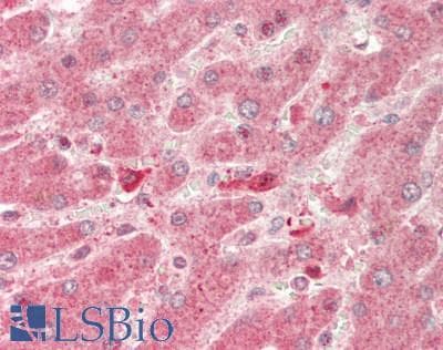 IHC-plus™ RICTOR Antibody (aa1650-C-term)