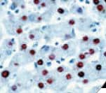 Polyclonal Rabbit anti-Hepatitis B Virus HBcAg / HBV Core Antigen Antibody (IHC)