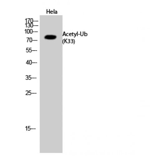Ubiquitin Antibody (around the acetylation site of K33.)