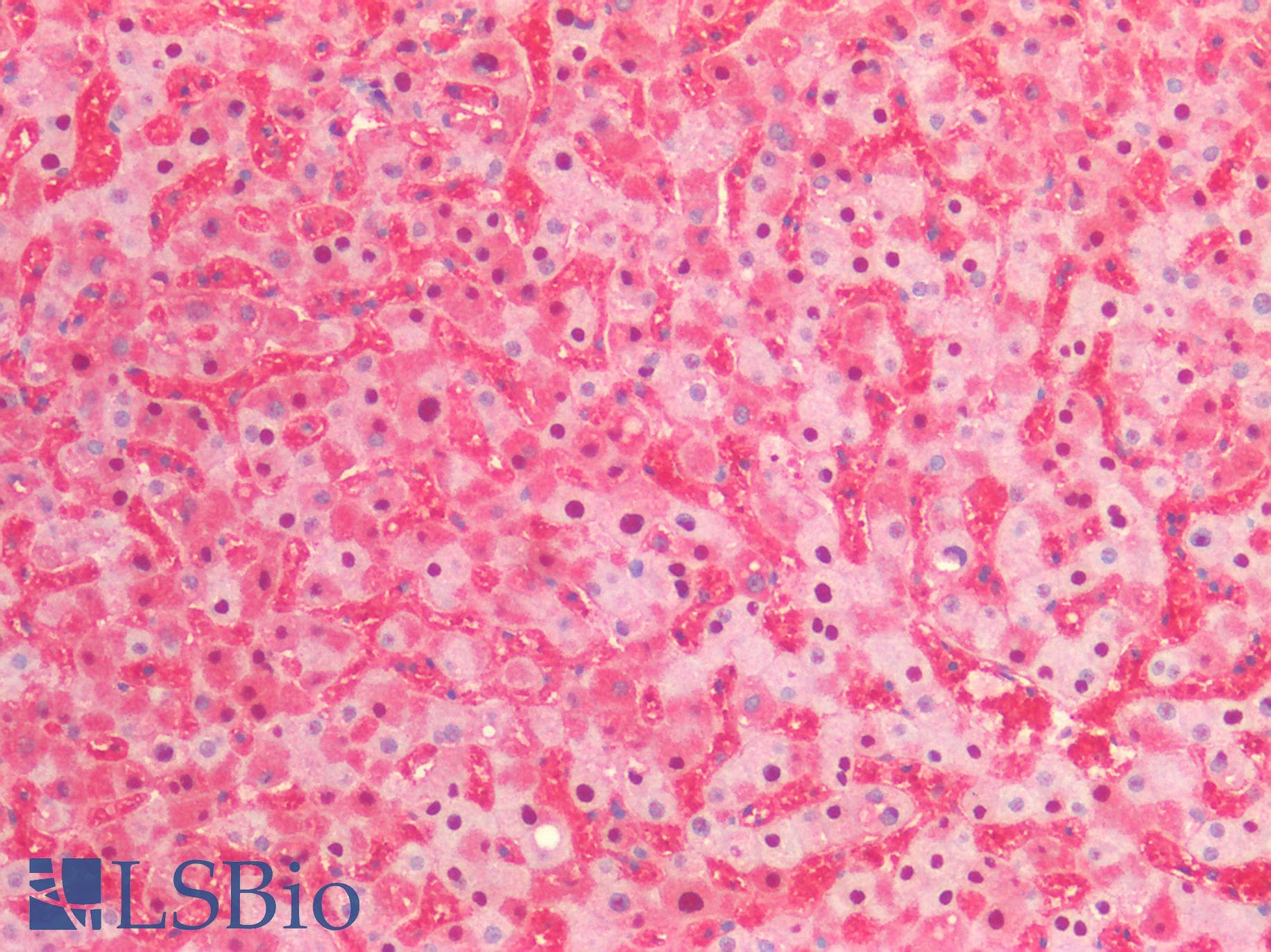 PathPlus™ Polyclonal Rabbit anti-Human ENO1 / Alpha Enolase Antibody (IHC, WB)
