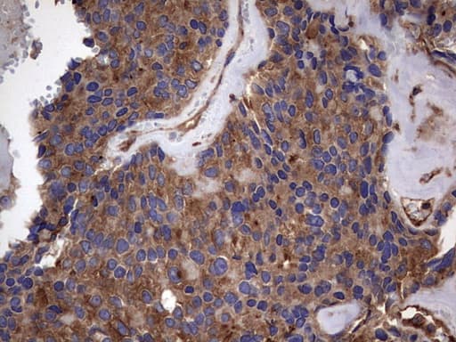 KRT7 / CK7 / Cytokeratin 7 Antibody (clone OTI2A2)