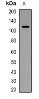 Polyclonal Rabbit anti-Human PARP1 Antibody (Internal, WB)