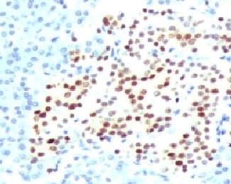 NKX2-2 Antibody (clone RMNK2-1)