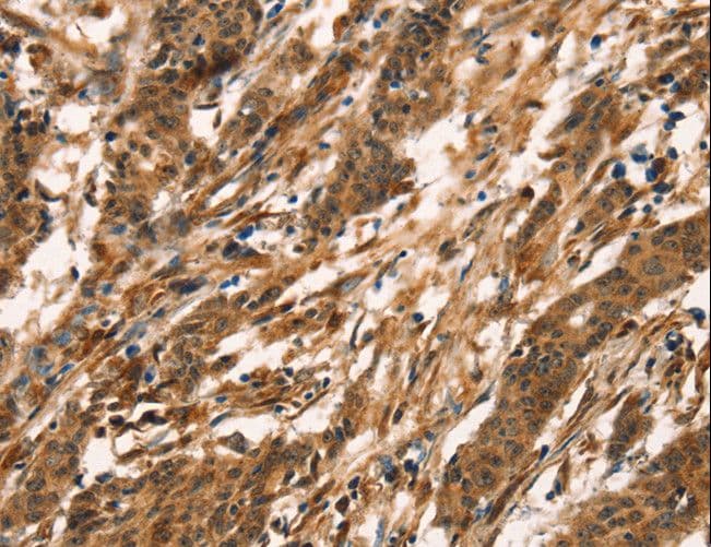 KLRC1 / NKG2A / CD159a Antibody