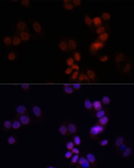 KDM7A / JHDM1D Antibody