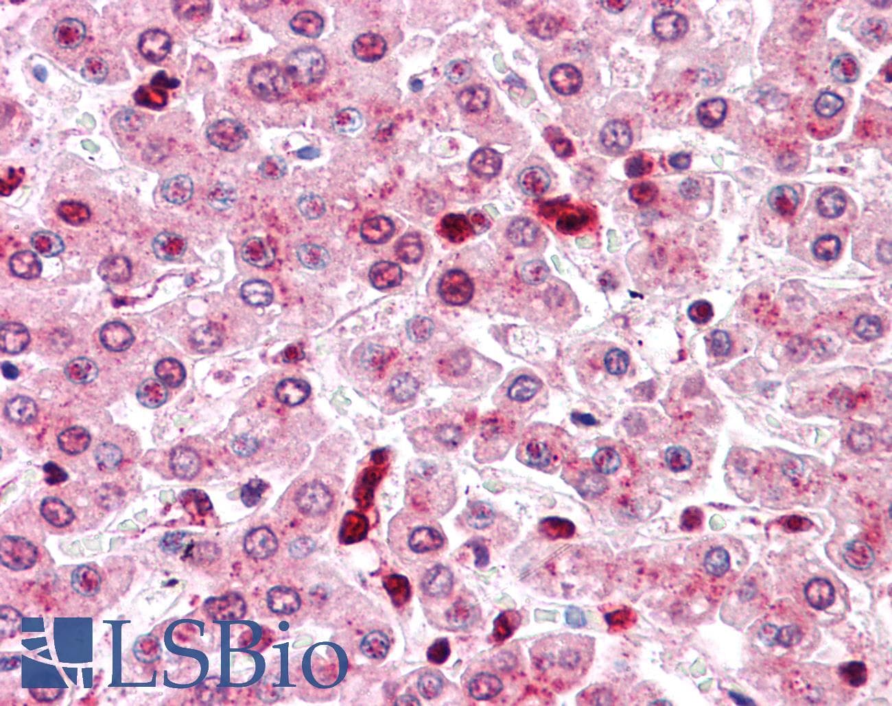 IHC-plus™ Polyclonal Rabbit anti-Human COMT Antibody (Internal, IHC)