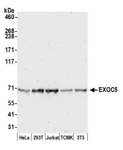 Polyclonal Rabbit anti-Human EXOC5 Antibody (aa658-708, WB)
