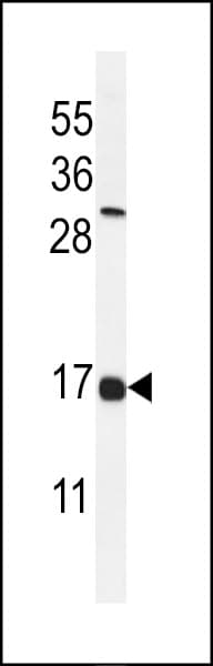 IHC-plus™ IFITM2 Antibody (aa1-30)