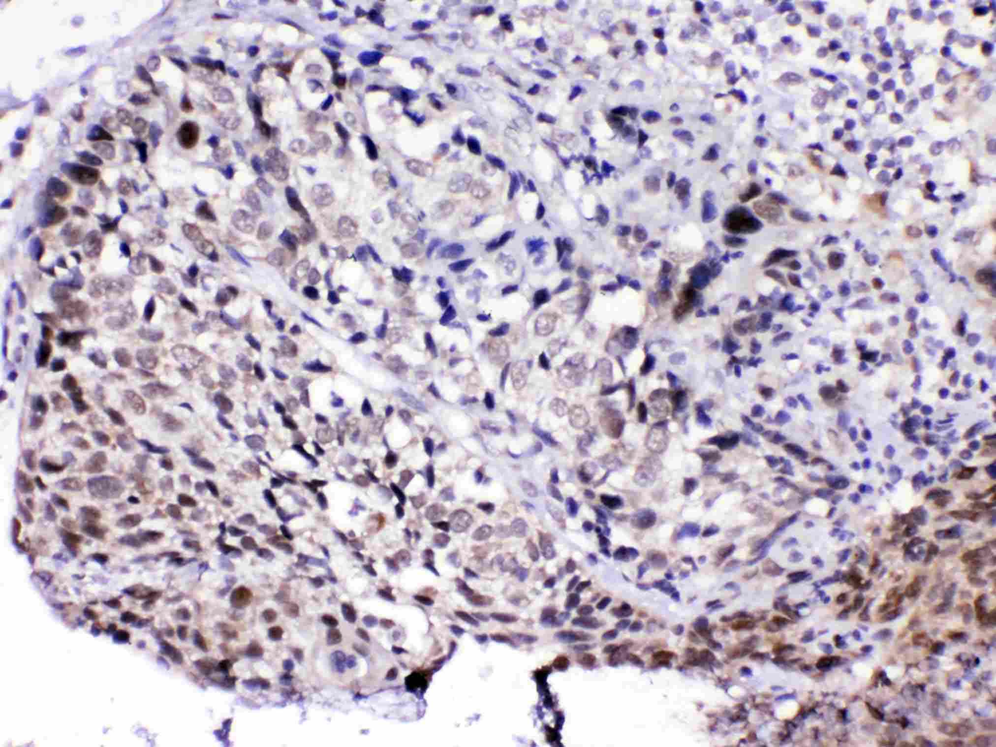 MED15 / ARC105 Antibody