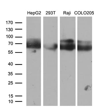 CACNB1 Antibody (aa1-269, clone OTI3H6)