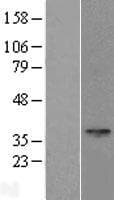 SPEM1 Protein (Over-Expression Lysate Myc-DDK (Flag))