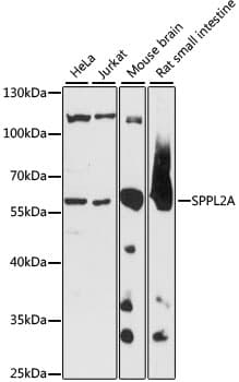 SPPL2A / IMP3 Antibody