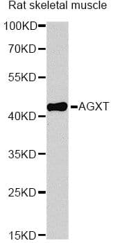 Polyclonal Rabbit anti-Human AGXT / SPT Antibody (WB)