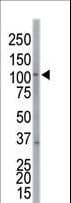 EPHA7 / EPH Receptor A7 Antibody (aa896-925)