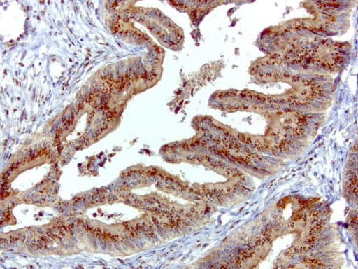 Monoclonal Mouse anti-Human SQSTM1 Antibody (clone UMAB12, Carrier-free, IHC, IF, WB)