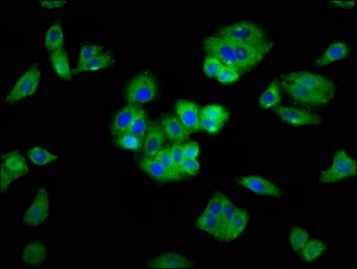 Polyclonal Rabbit anti-Human SEMA5A / Semaphorin 5A Antibody