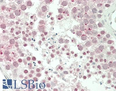 IHC-plus™ Polyclonal Rabbit anti-Human GOLGA2 / GM130 Antibody (IHC, IF, WB)