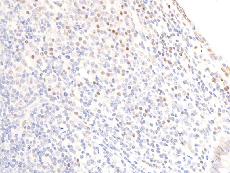 EGFR Antibody (phospho-Ser1071)