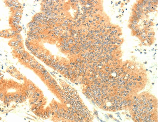 Polyclonal Rabbit anti-Human TRAF3IP2 / ACT1 Antibody (IHC, WB)