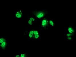 Monoclonal Mouse anti-Human PBX1 Antibody (clone OTI1C11, IHC, IF, WB)