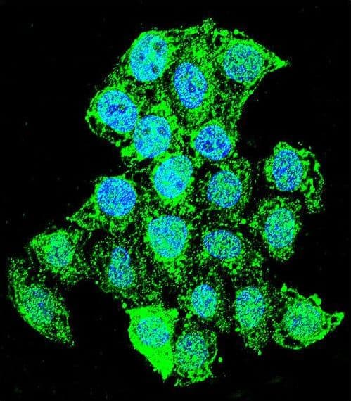 ZMYND17 Antibody (aa402-430)