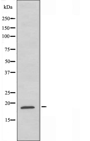 RPL35 / Ribosomal Protein L35 Antibody