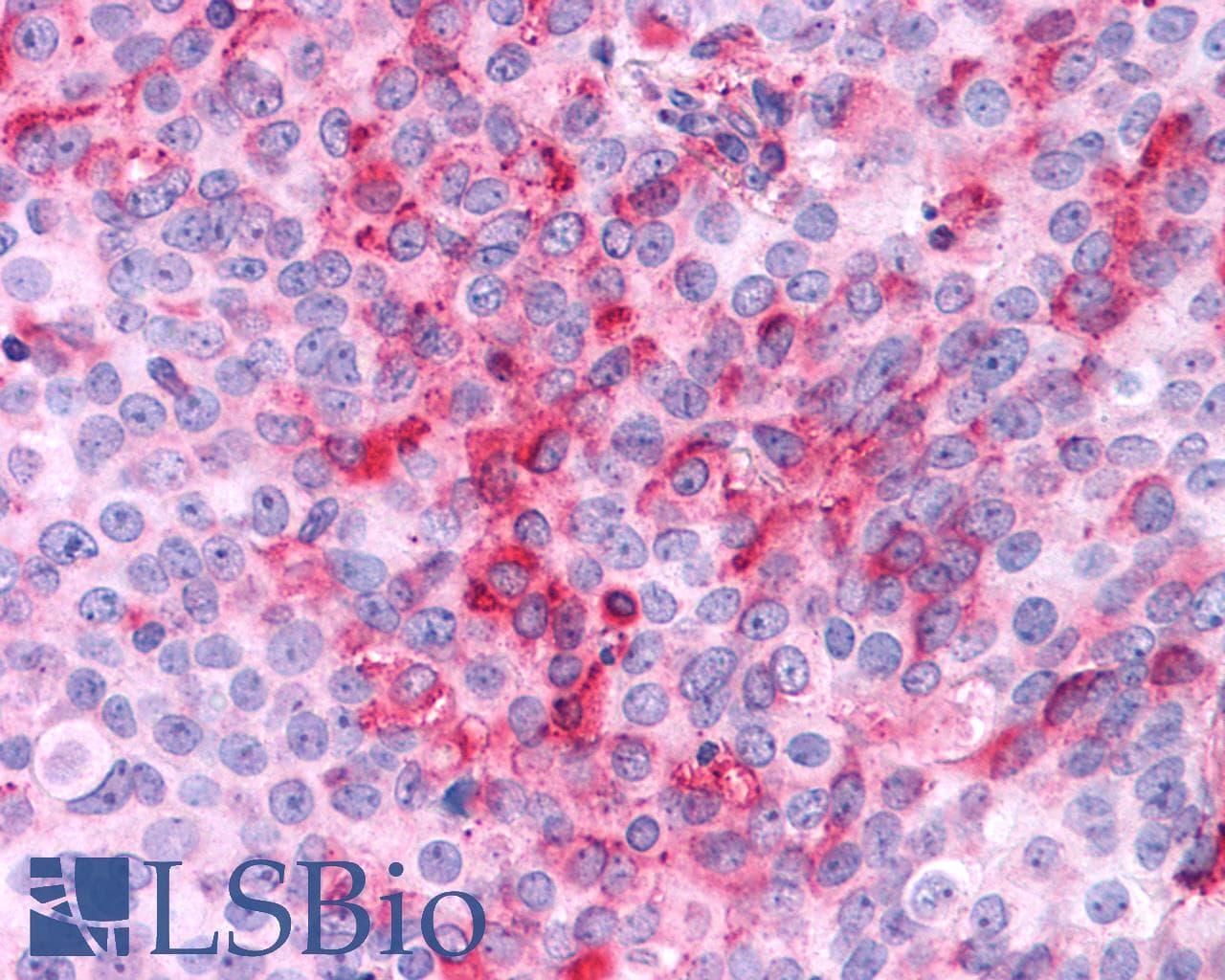 PathPlus™ FZD9 / Frizzled 9 Antibody (N-Terminus)