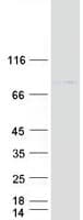 Human ACCN4 / ASIC4 Protein (Recombinant Myc-DDK (Flag))