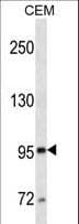 Monoclonal Mouse anti-Human MME / CD10 Antibody (aa272-300, WB)