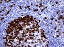 Monoclonal Mouse anti-Human TS / Thymidylate Synthase Antibody (clone OTI1D6, IHC, WB)