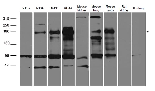 CFTR Antibody