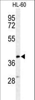Polyclonal Rabbit anti-Human CYTB / MT-CYB Antibody (aa201-228, WB)