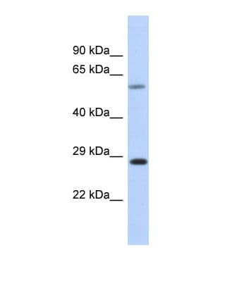 Polyclonal Rabbit anti-Human CEP70 Antibody (N-Terminus, WB)