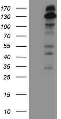 IRS1 Antibody (aa1-280, clone OTI2B10)