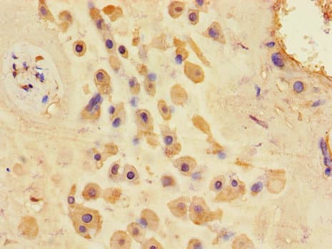 Polyclonal Rabbit anti-Human Hamartin / TSC1 Antibody (IHC, IF)