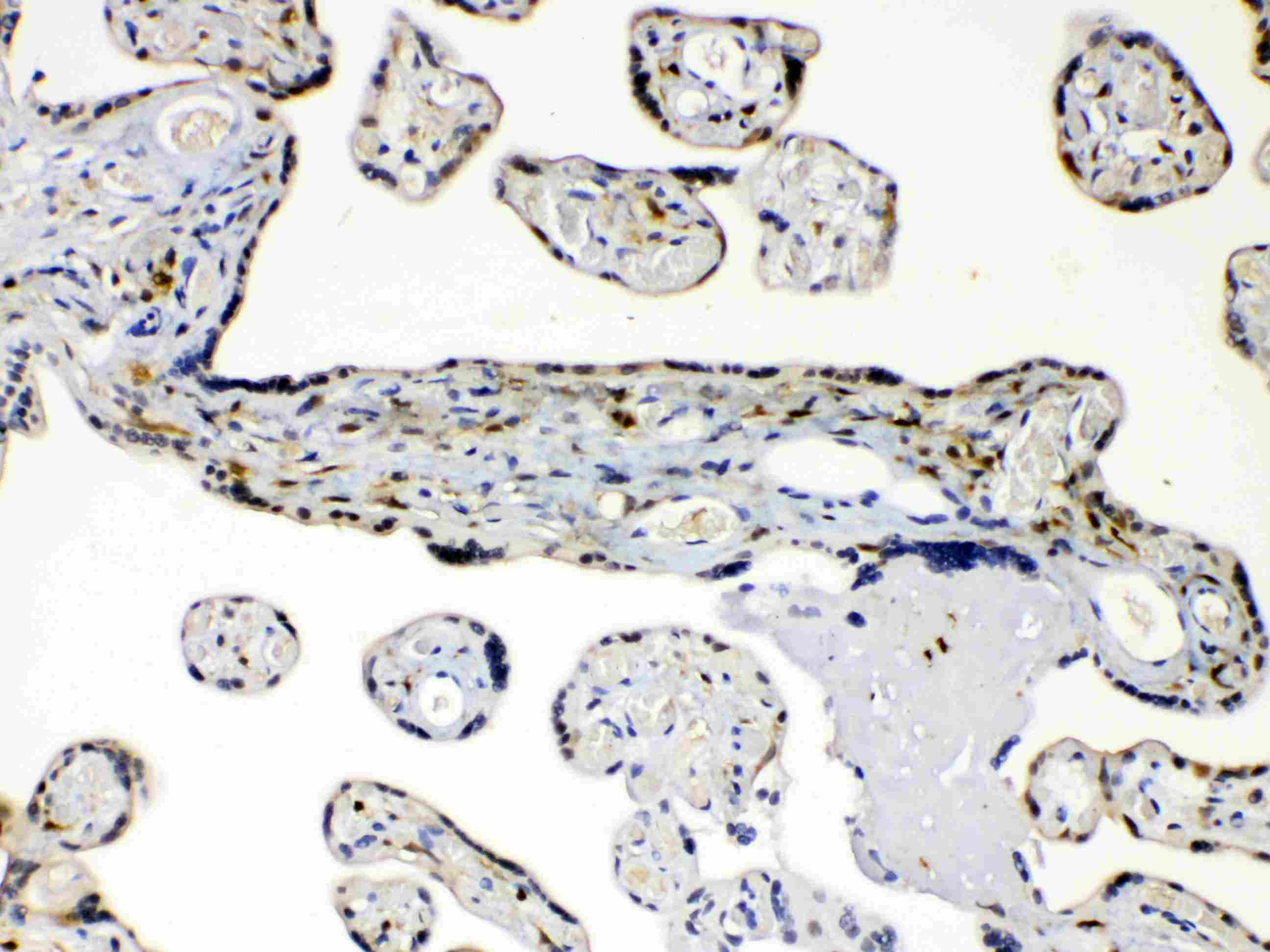 AKR1B1 / Aldose Reductase Antibody
