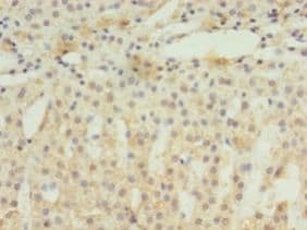 EIF4EBP3 Antibody (aa1-100)