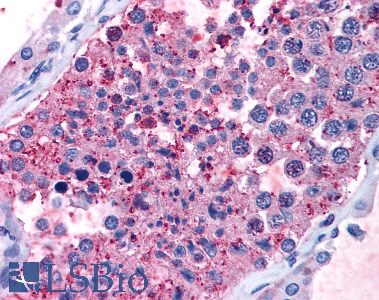 IHC-plus™ Polyclonal Rabbit anti-Human ADGRD1 / GPR133 Antibody (C-Terminus, IHC)