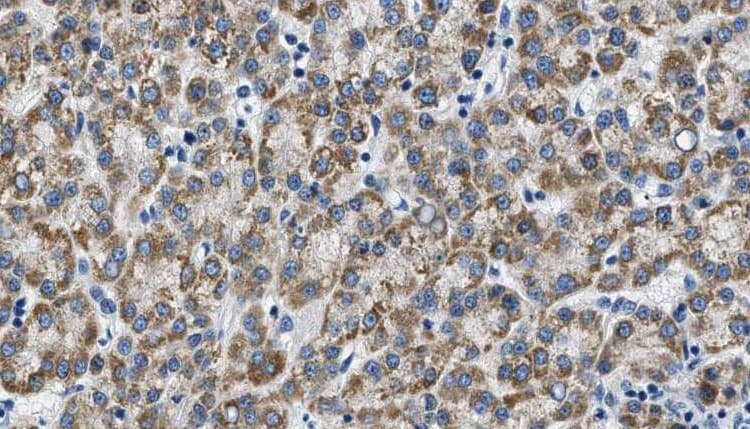 Polyclonal Rabbit anti-Human CDH3 / P-Cadherin Antibody (IHC, IF, WB)