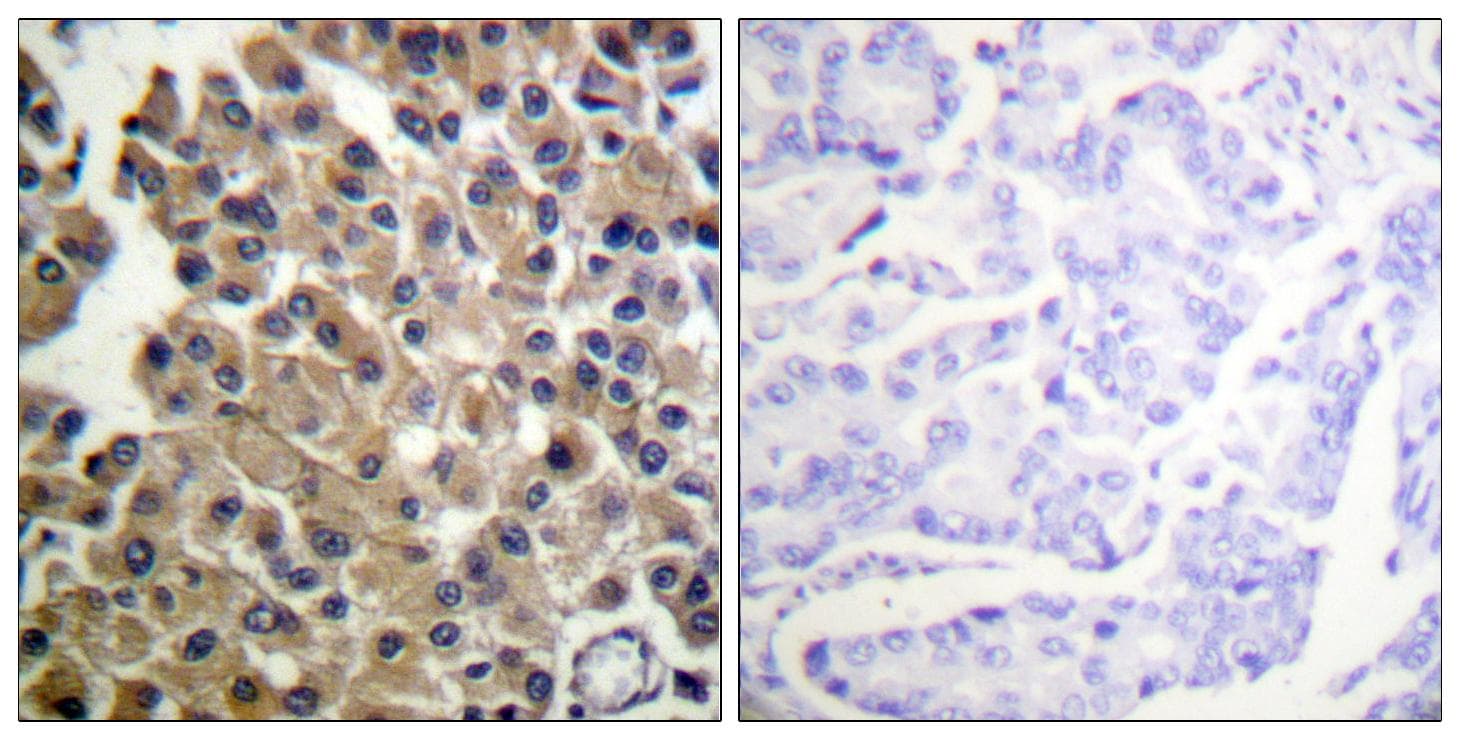PDGFRB / PDGFR Beta Antibody