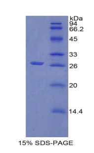 Sheep CTGF Protein (Recombinant His)