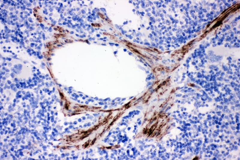 Polyclonal Rabbit anti-Human CNN1 / Calponin Antibody (aa283-297, IHC, WB)