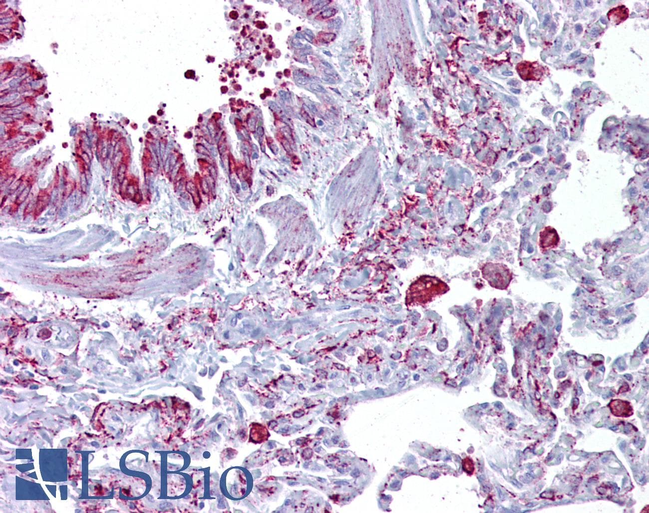 GABRB3 Antibody (aa180-229, Biotin)