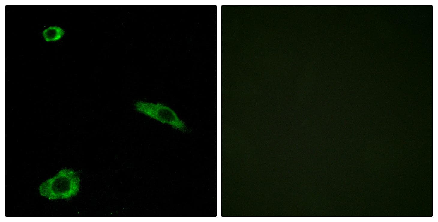 Polyclonal Rabbit anti-Human MC2R / ACTHR / ACTH Receptor Antibody (IF, WB)
