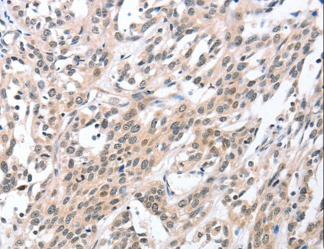 HDAC8 Antibody