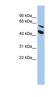MMP24 Antibody (aa468-517)